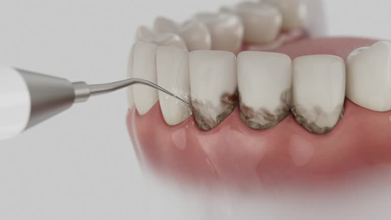 Trusted Root Canal Treatment service in South Pittsburg, TN - Dentist Open Now